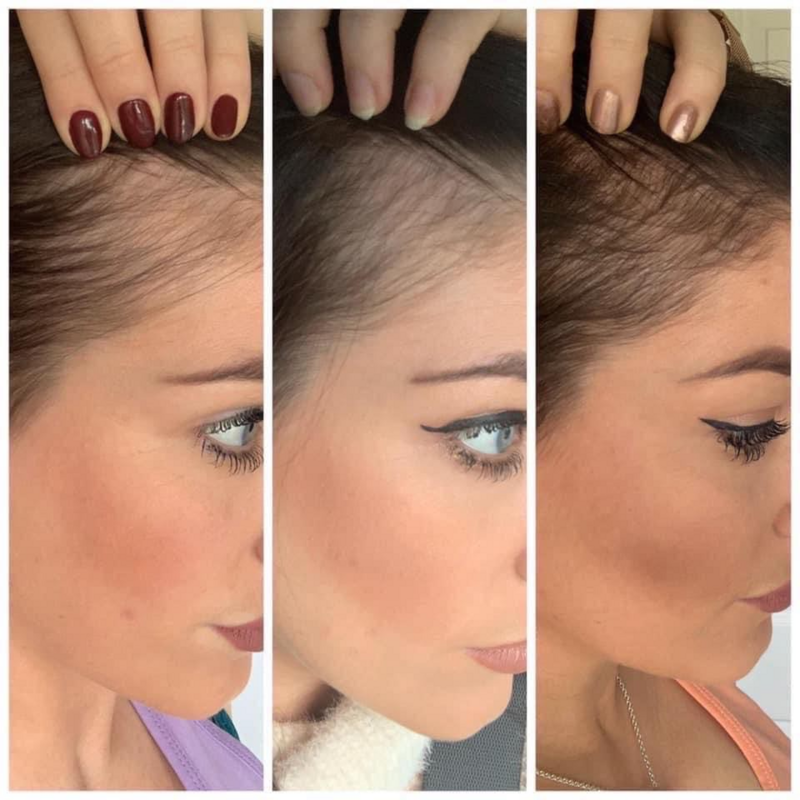 Scalp &amp; Hair System
