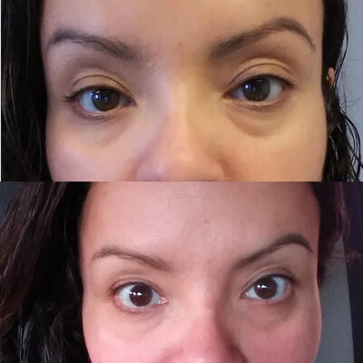 Ideal Eyes Eye Cream - For Bags and Dark Circles