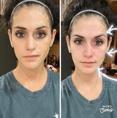 Instant Face Lift Treatment