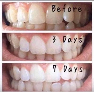Buy 3 Get 4 Free Toothpaste