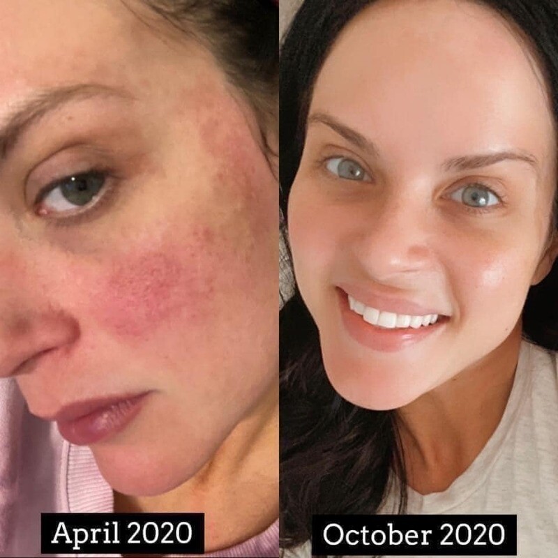 LumiSpa iO *PRICE REDUCTION!*