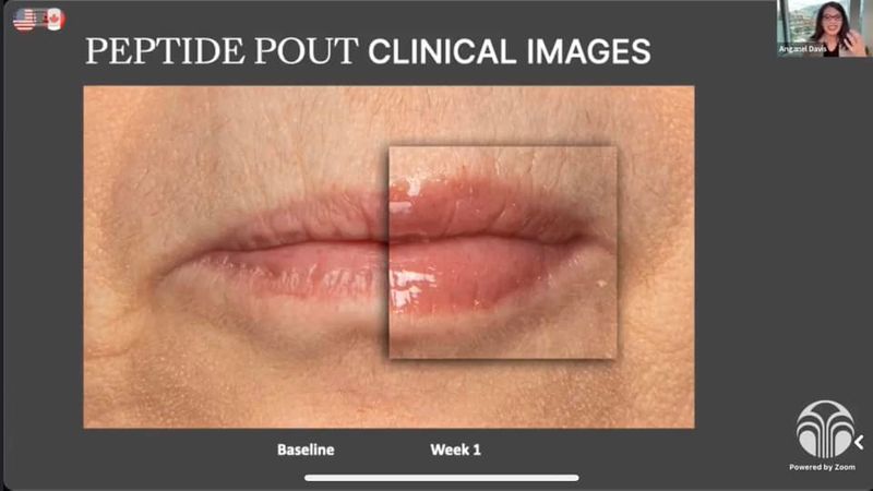 Lip Peptide Pout