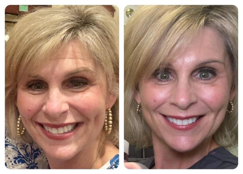 ageLOC® Tru Face® Peptide Retinol Complex