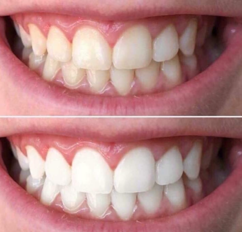 AP24 Whitening Toothpaste