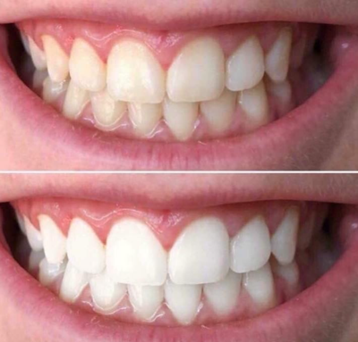AP24 Whitening Toothpaste