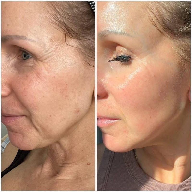 ageLOC Tru Face Future Serum