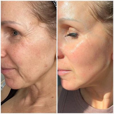 ageLOC Tru Face Future Serum