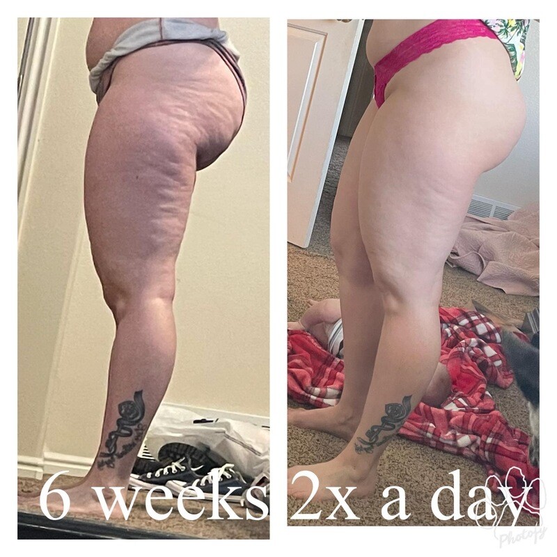 Dermatic Effects Firming/cellulite Lotion