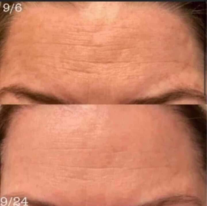 Line Corrector