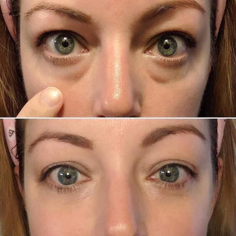 Ideal Eyes