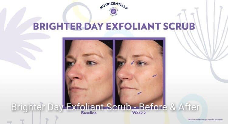 Brighter Day Exfoliant Scrub
