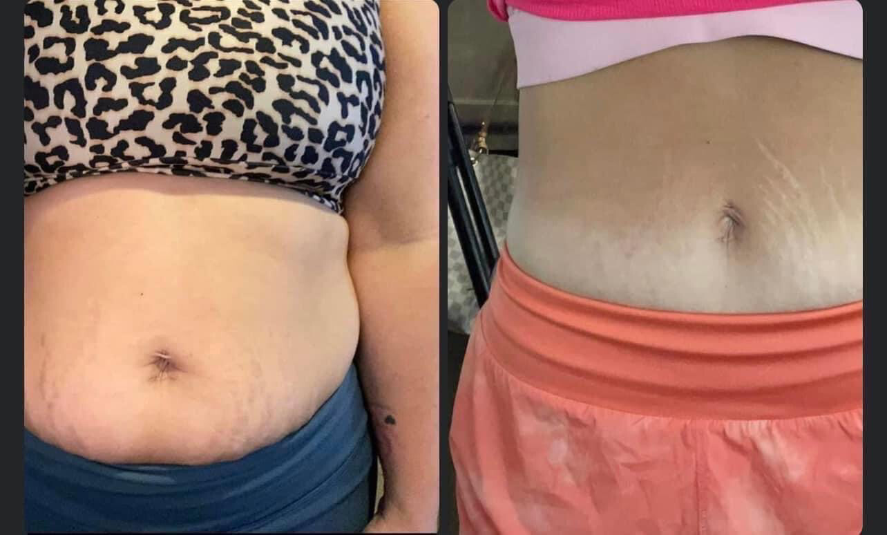 Cellulite/Firming Cream! 3 Pack!