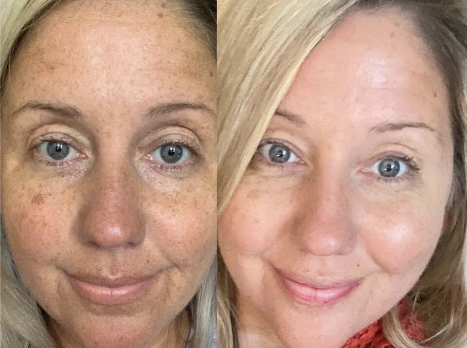 Vitamin C/180 Wash + Mask