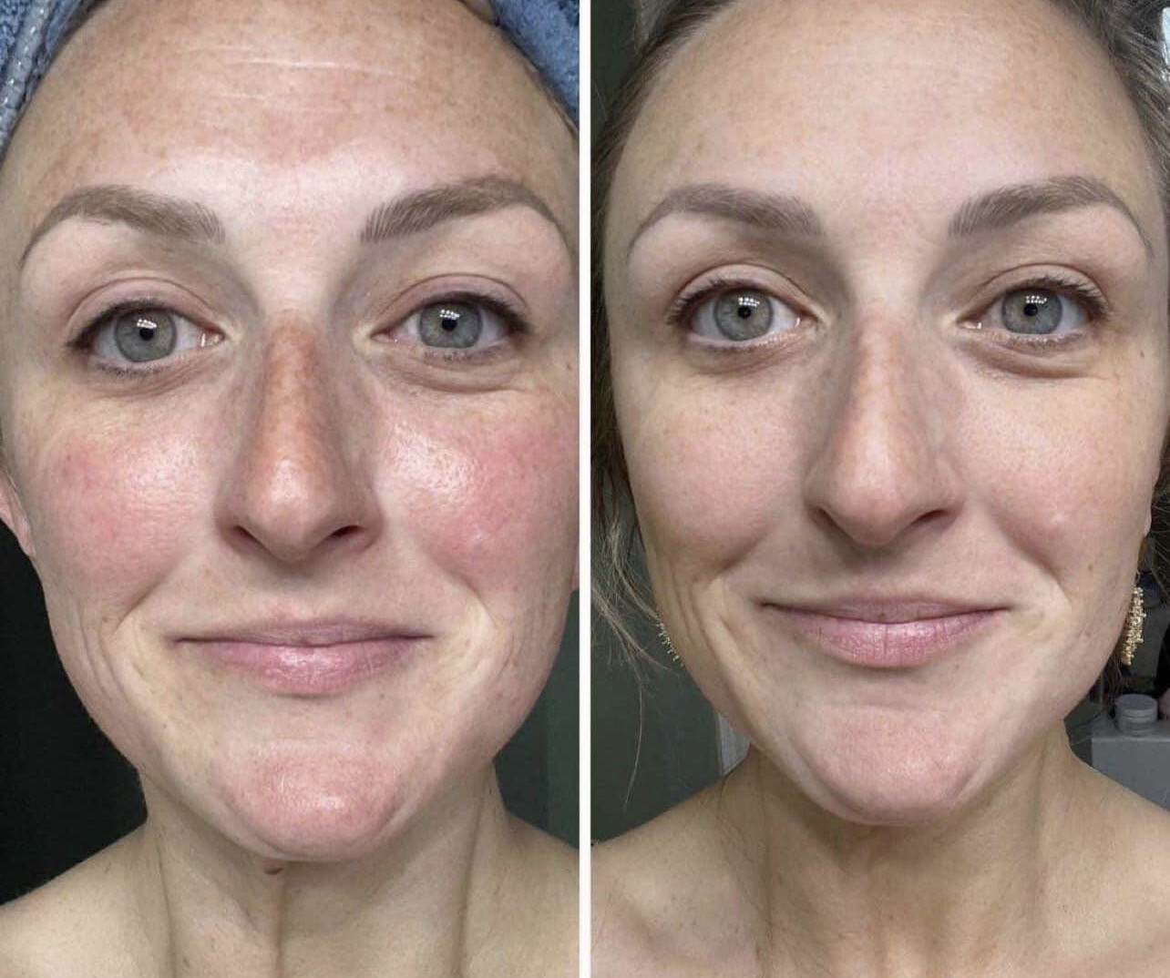Vitamin C/180 Wash + Mask