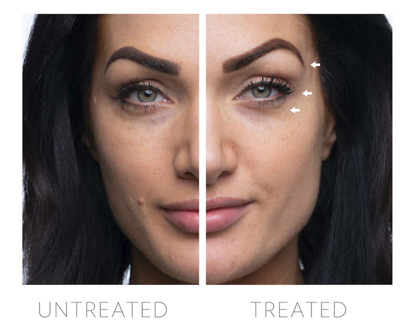 Rose Gold Eye Attachment Set For LUMI IO