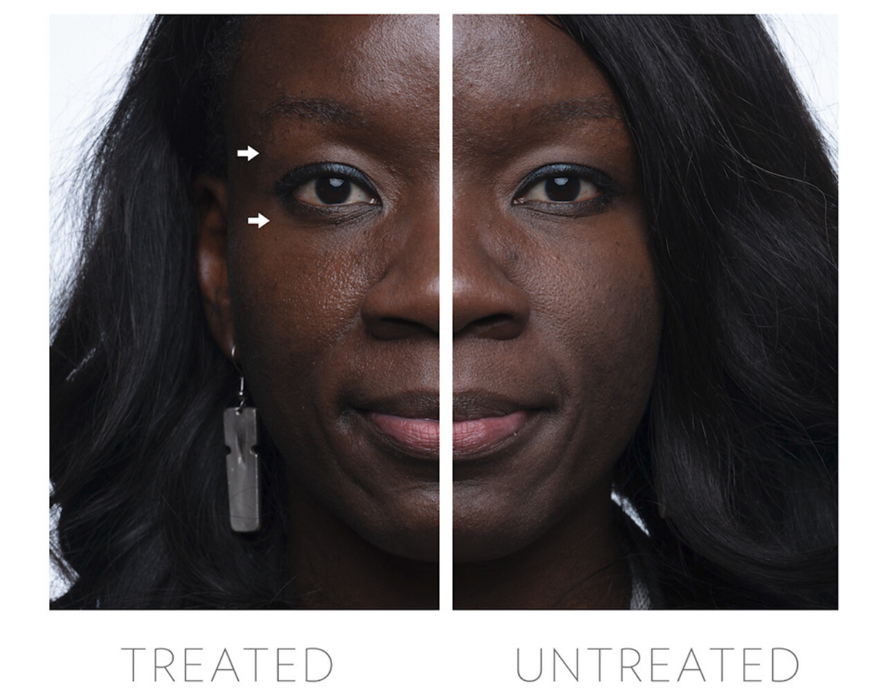 Rose Gold Eye Attachment Set For LUMI IO