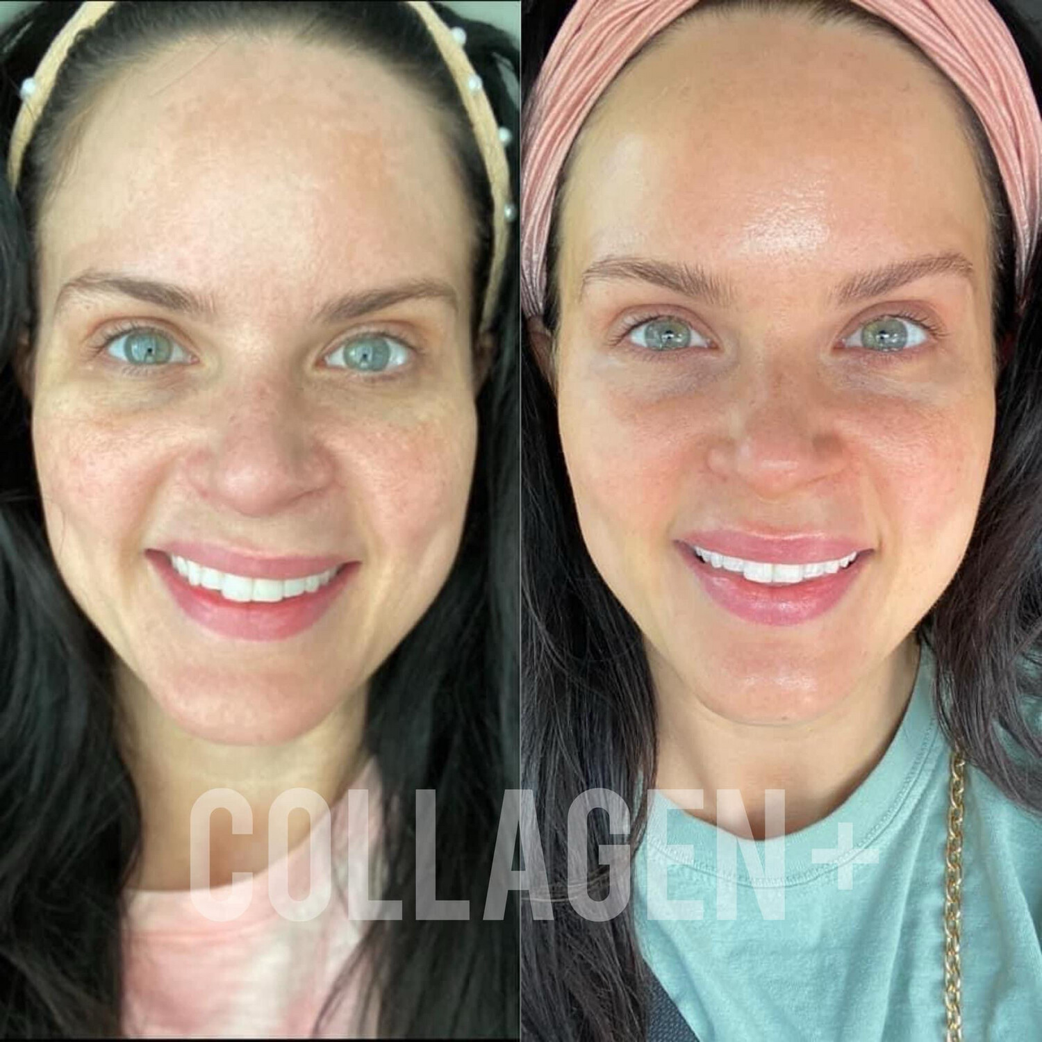 Beauty Focus Liquid Collagen