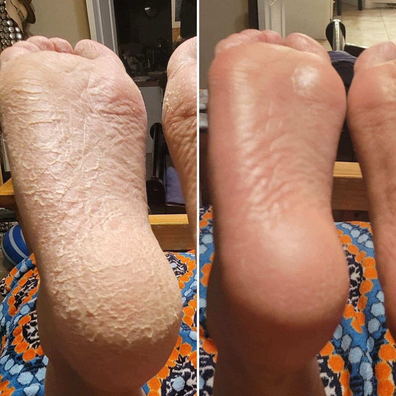 Healing Foot cream