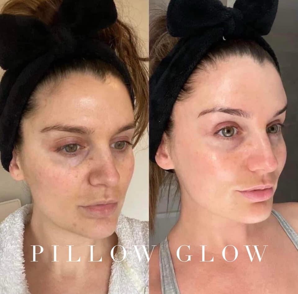 Pillow Glow Sleeping Mask