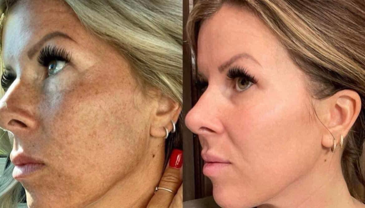 Vitamin C/180 Wash + Mask