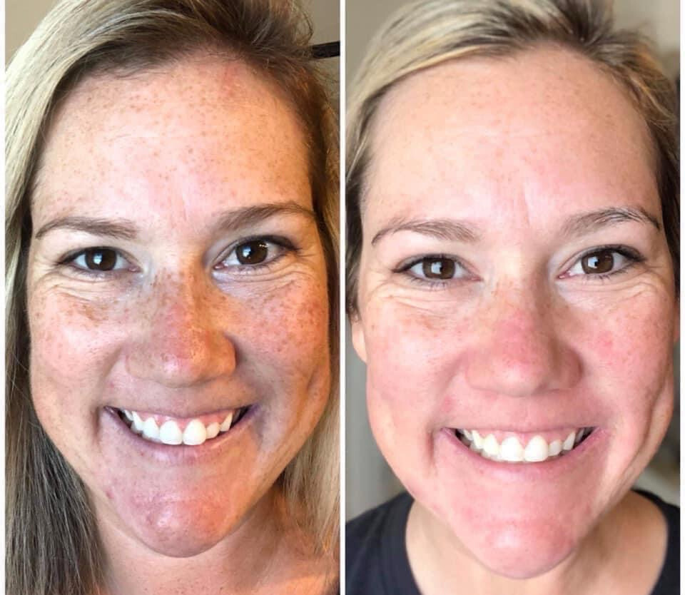 Vitamin C/180 Wash + Mask