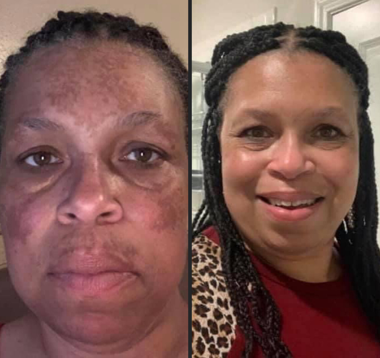 Vitamin C/180 Wash + Mask