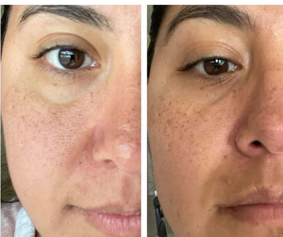 Vitamin C/180 Wash + Mask