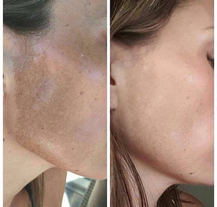 Vitamin C/180 Wash + Mask