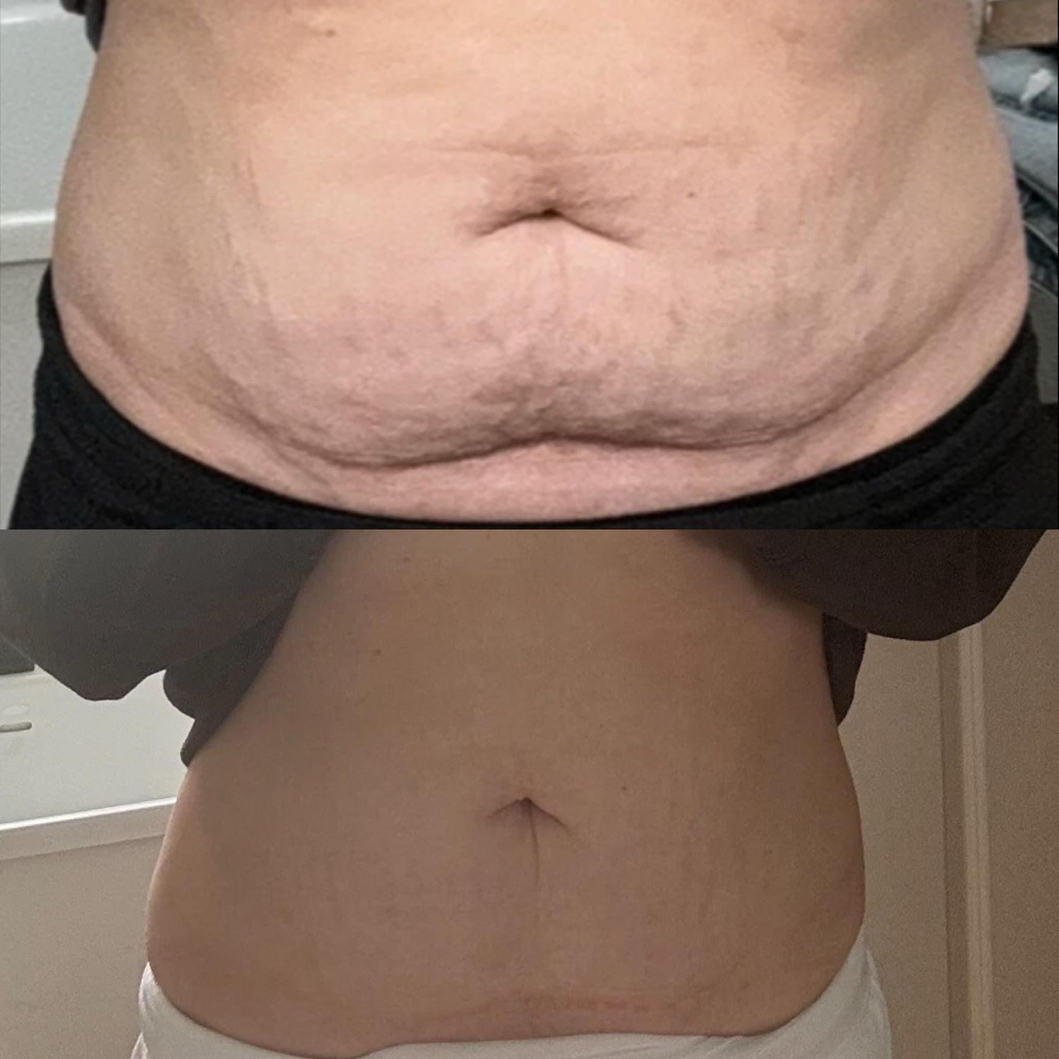 Body Sculpting Spa + Conducting Gel