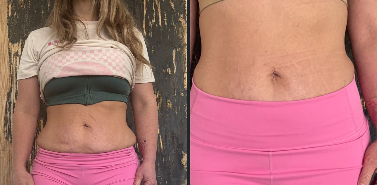 Body Sculpting Spa + Conducting Gel