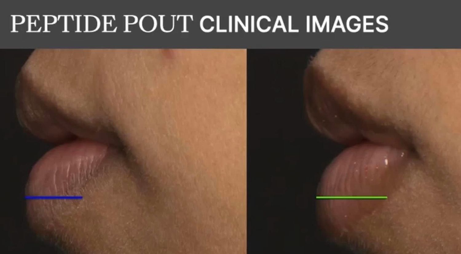 Lip Plumping Peptide Pout