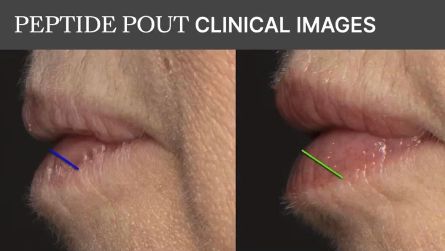 Lip Plumping Peptide Pout