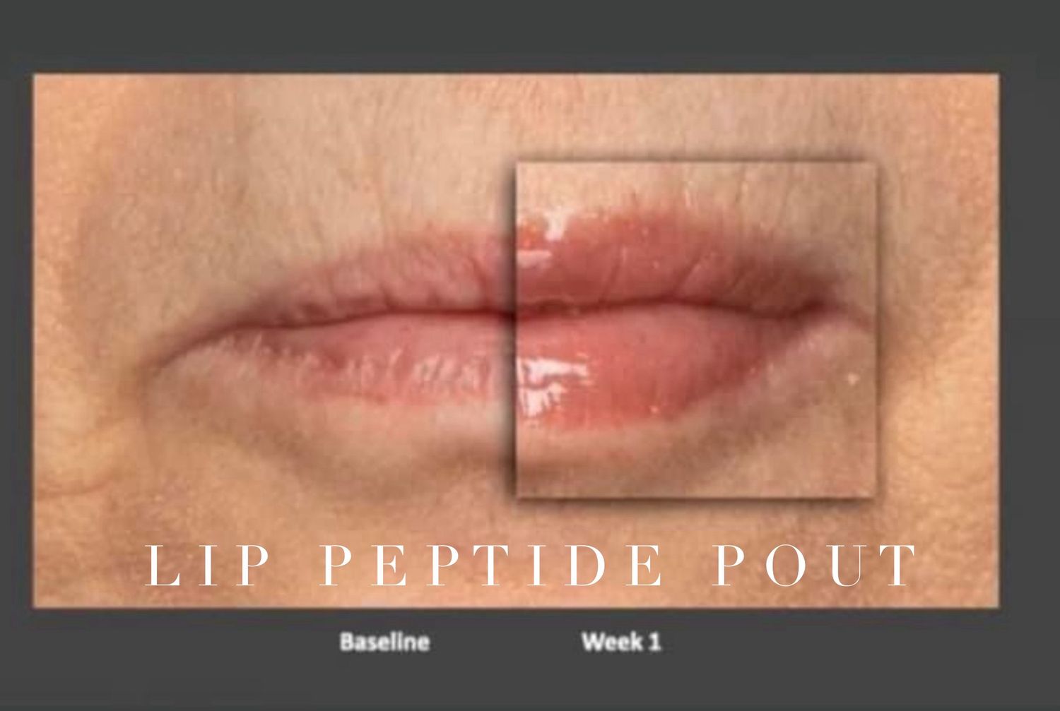 Lip Plumping Peptide Pout