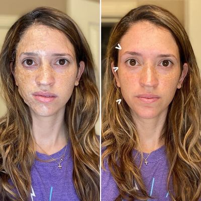 FaceLift