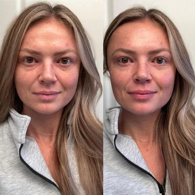 Healing Eye Cream