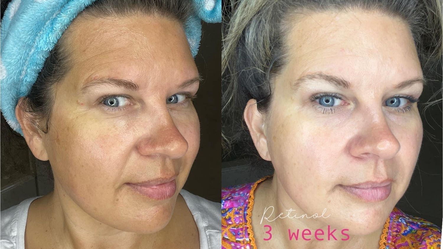 AgeLOC Tru Face PEPTIDE RETINOL COMPLEX (2 Containers)