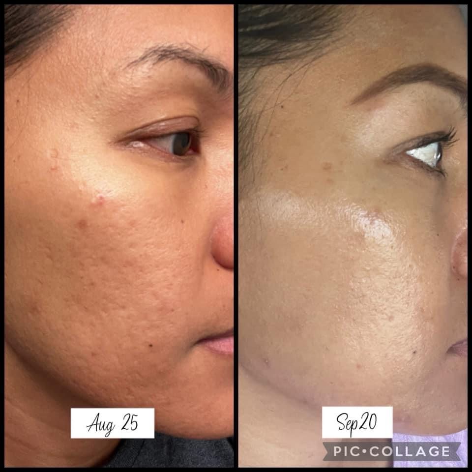 AgeLOC Tru Face PEPTIDE RETINOL COMPLEX (2 Containers)