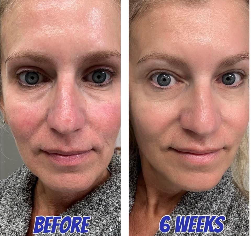 AgeLOC Tru Face PEPTIDE RETINOL COMPLEX (2 Containers)