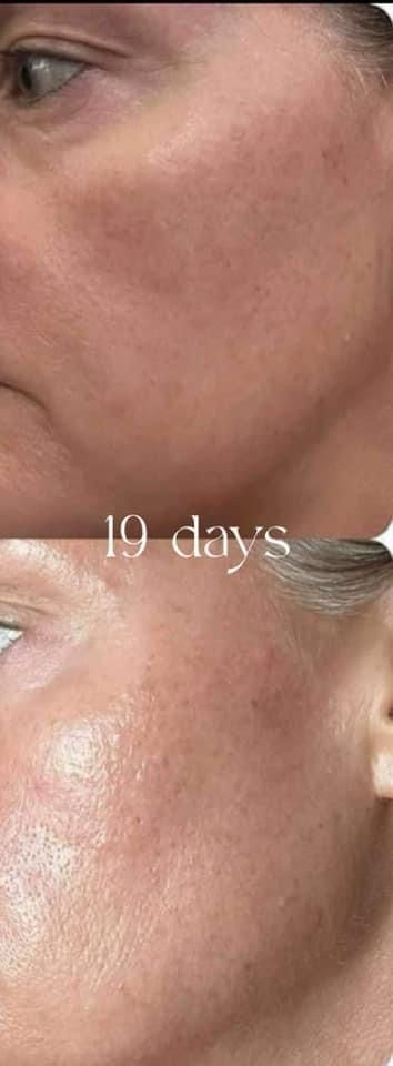 AgeLOC Tru Face PEPTIDE RETINOL COMPLEX (2 Containers)