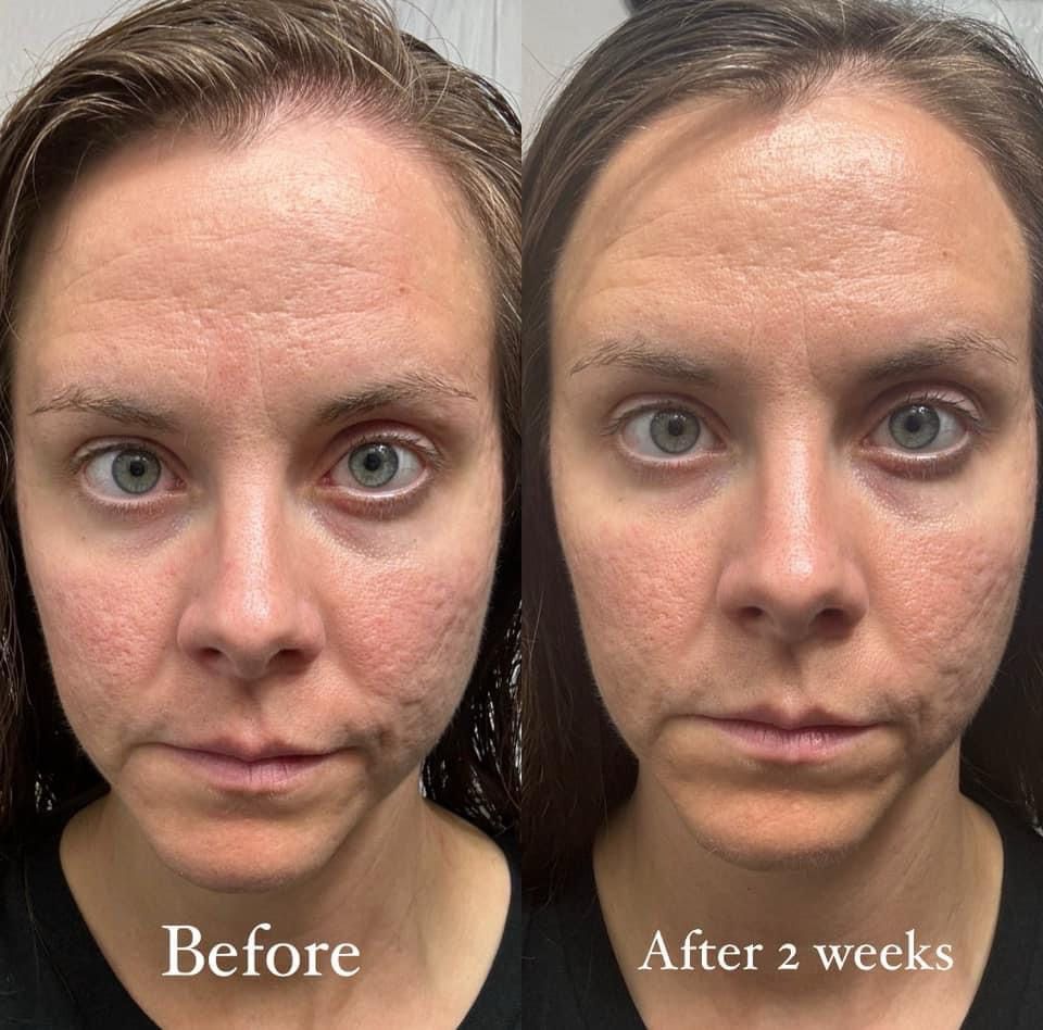 AgeLOC Tru Face PEPTIDE RETINOL COMPLEX (2 Containers)