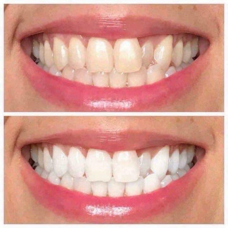 Whitening Toothpaste
