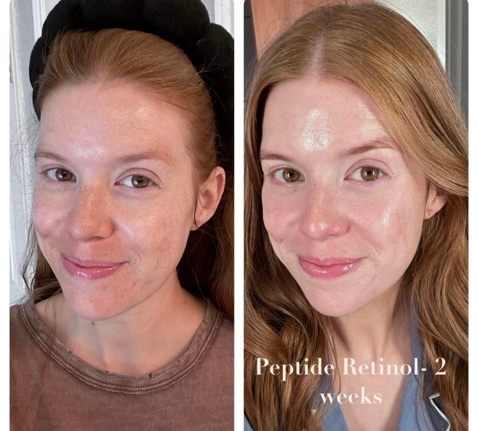 Peptide Retinol Complex + Boujee Moisturizer