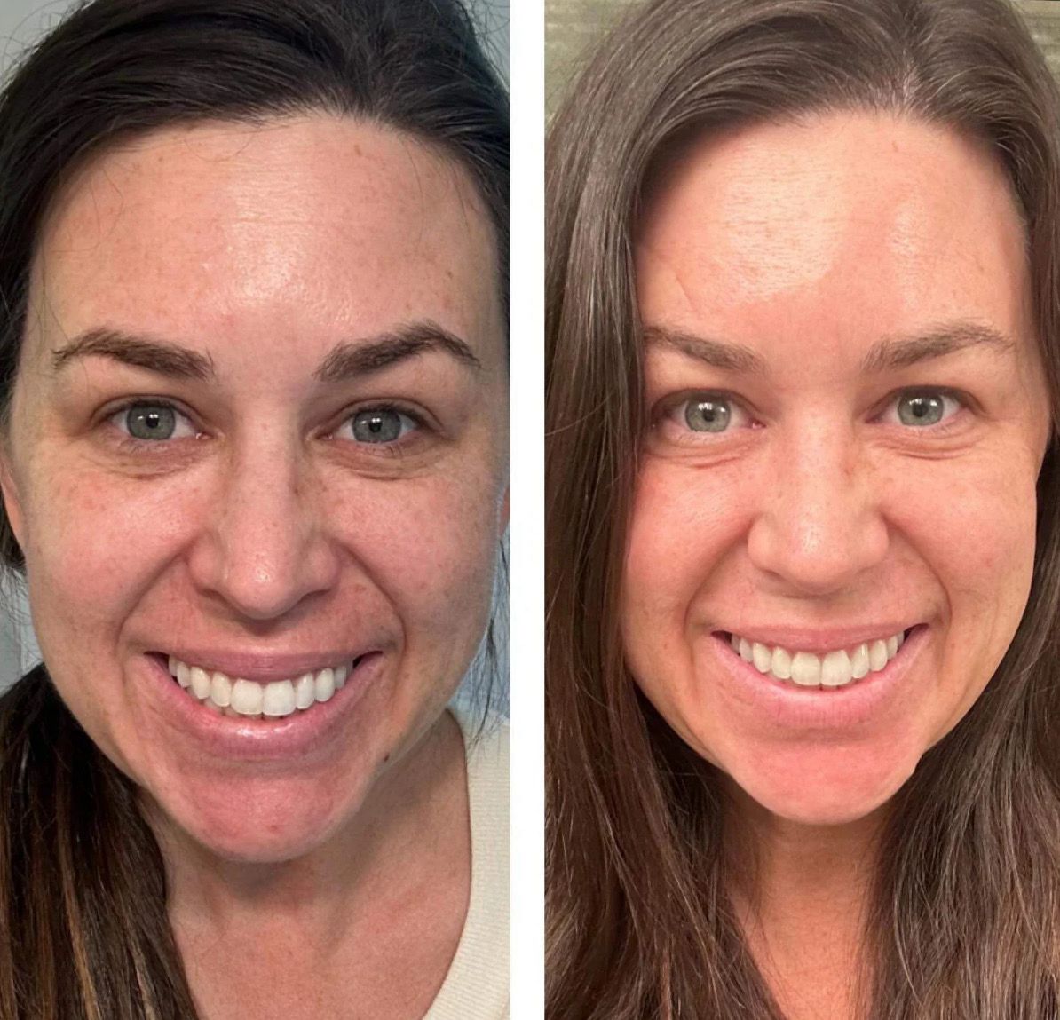 Peptide Retinol Complex + Boujee Moisturizer