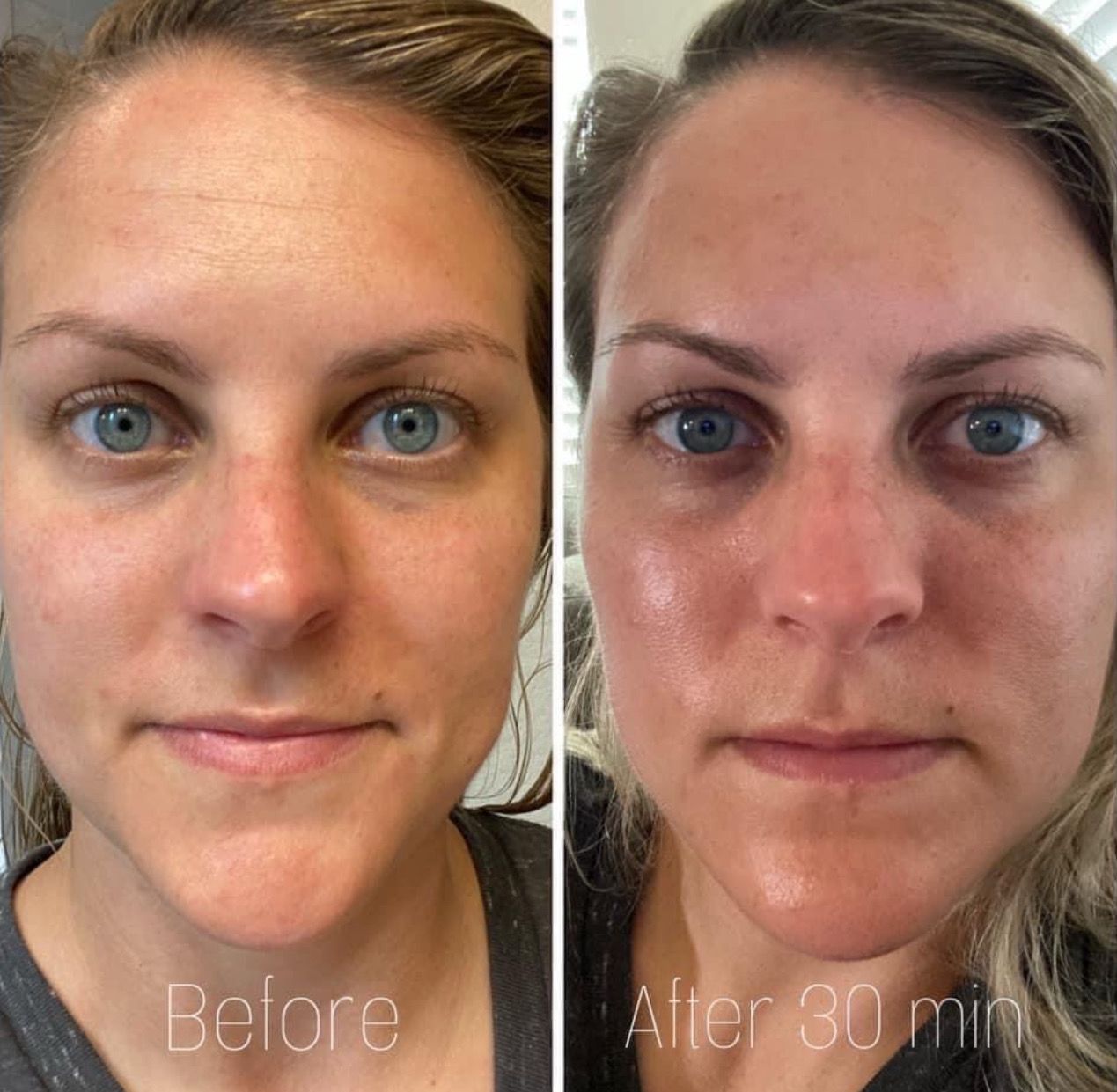 Peptide Retinol Complex + Boujee Moisturizer