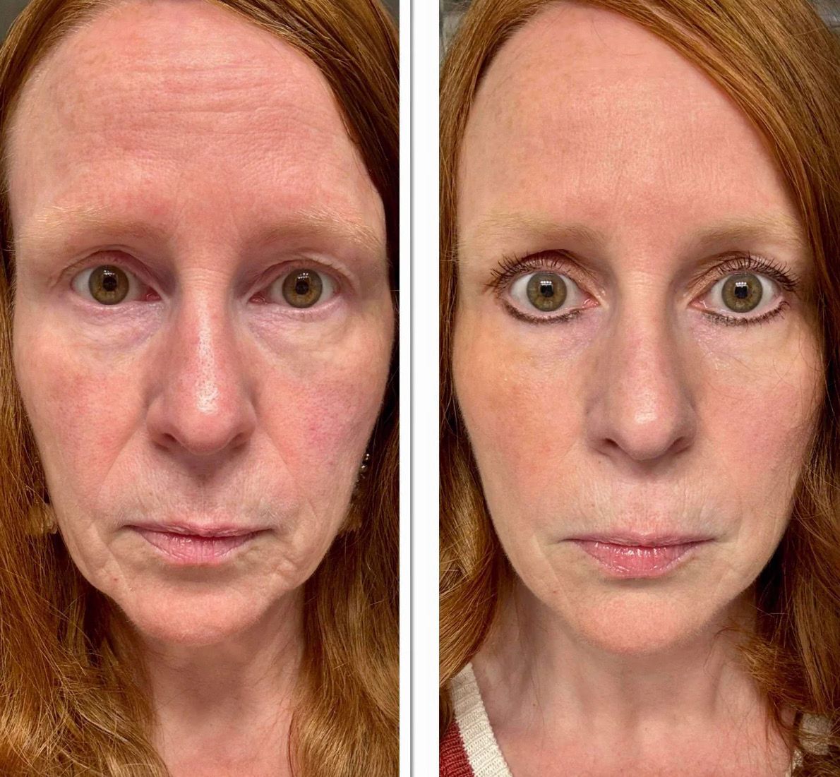 Peptide Retinol Complex + Boujee Moisturizer