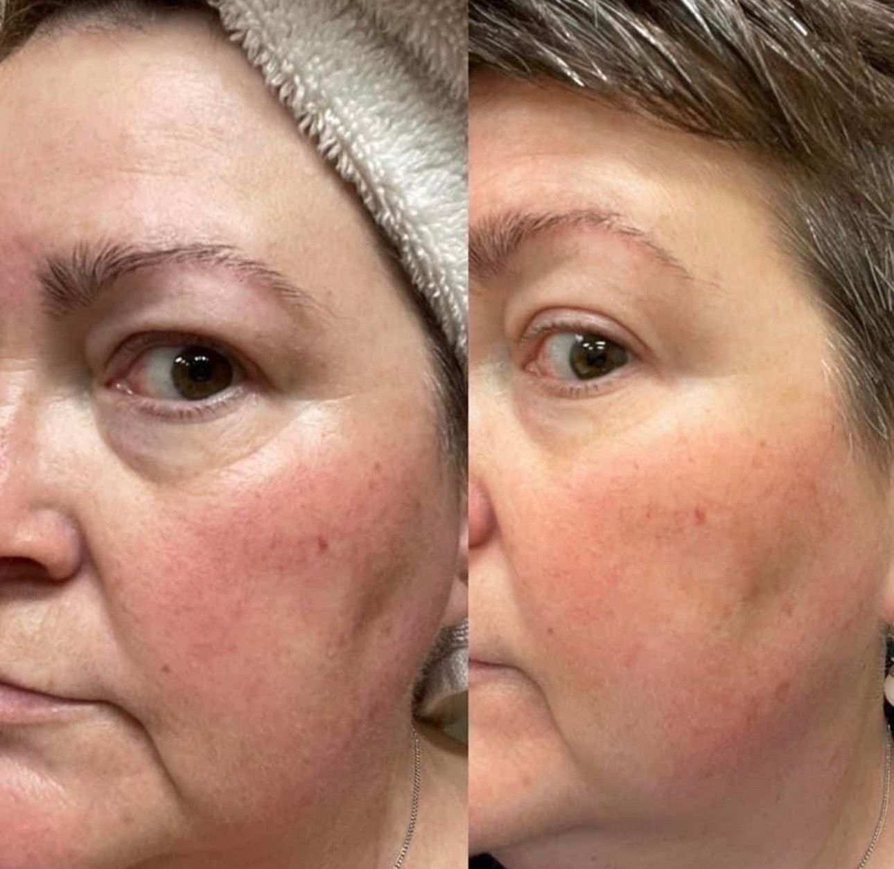 Peptide Retinol Complex + Boujee Moisturizer