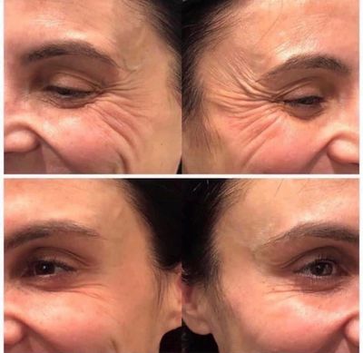 AgeLOC Tru Face Peptide Retinol Complex + AgeLOC Tru Face Essence Ultra Serum Pearls Pouch & AgeLOC Tru Face Essence Ultra Rich Uplifting Cream
