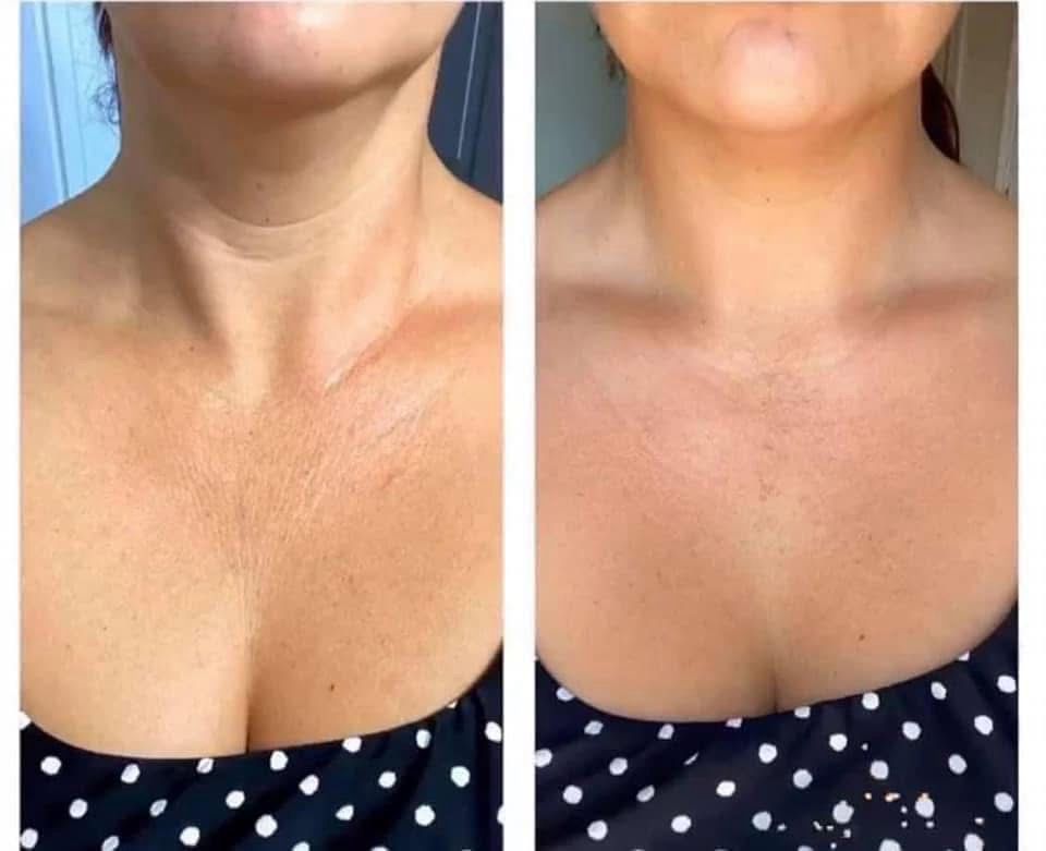 Cellulite/Firming Cream! 3 Pack!