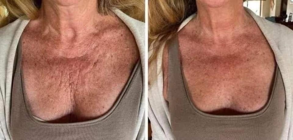 Cellulite/Firming Cream! 3 Pack!