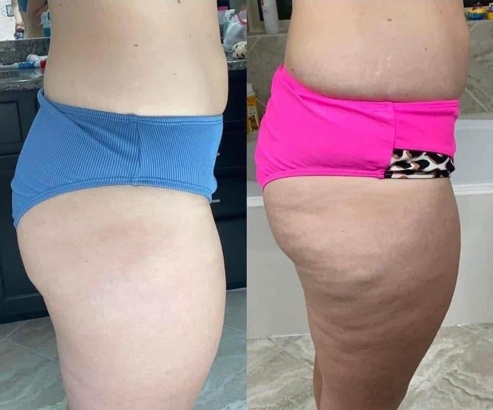 Cellulite/Firming Cream! 3 Pack!